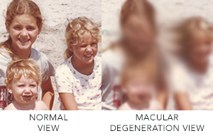 La dégénérescence maculaire liée à l'âge dégrade la vision au niveau du champ visuel central