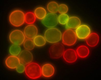 Figure 1 : Une image de protoplastes capturée à l'aide de la microscopie confocale (à gauche) qui est plus finement focalisée qu'une image de microsphères de taille similaire capturée à l'aide de la microscopie conventionnelle à épifluorescence.