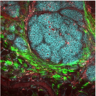 Figure 3 : Image d'une tumeur de souris capturée à l'aide de la microscopie multiphotonique, avec l'aimable autorisation du Laboratory for Optical and Computational Instrumentation (LOCI) de l'université du Wisconsin à Madison.