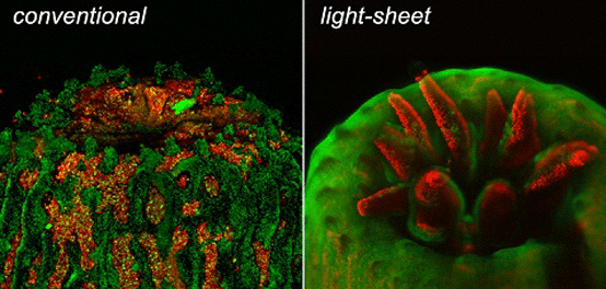 La microscopie à nappe de lumière